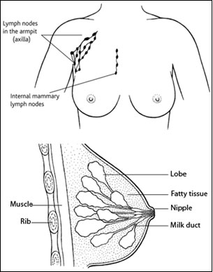 Understand Breast Cancer